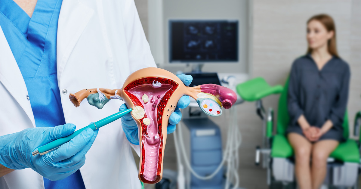 Uterine Fibroids - Women's Health Center of Southern Oregon - OB/GYN