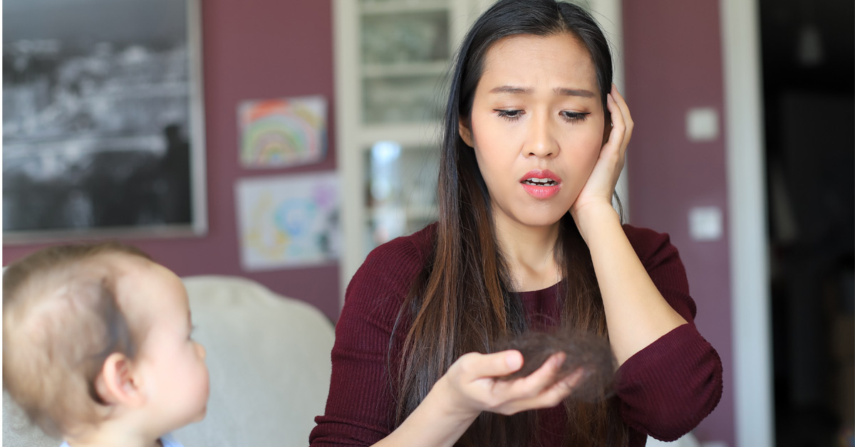 Postpartum Hair Loss